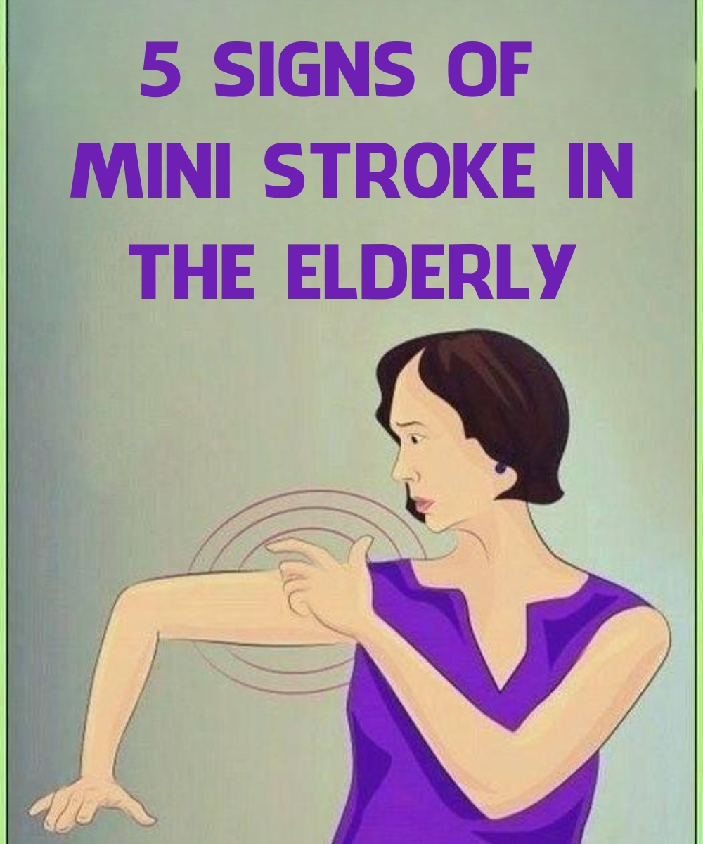 Mini Str0ke in the Elderly: Common and Unusual Symptoms