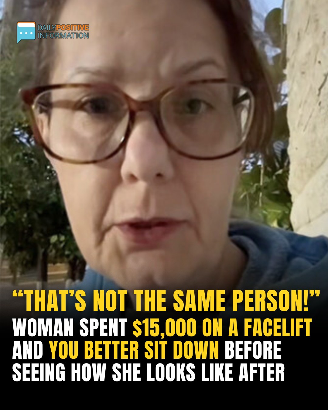 Facelifts Gone Viral: Woman Posts $15k Surgery Reveal—Reaction Is Intense