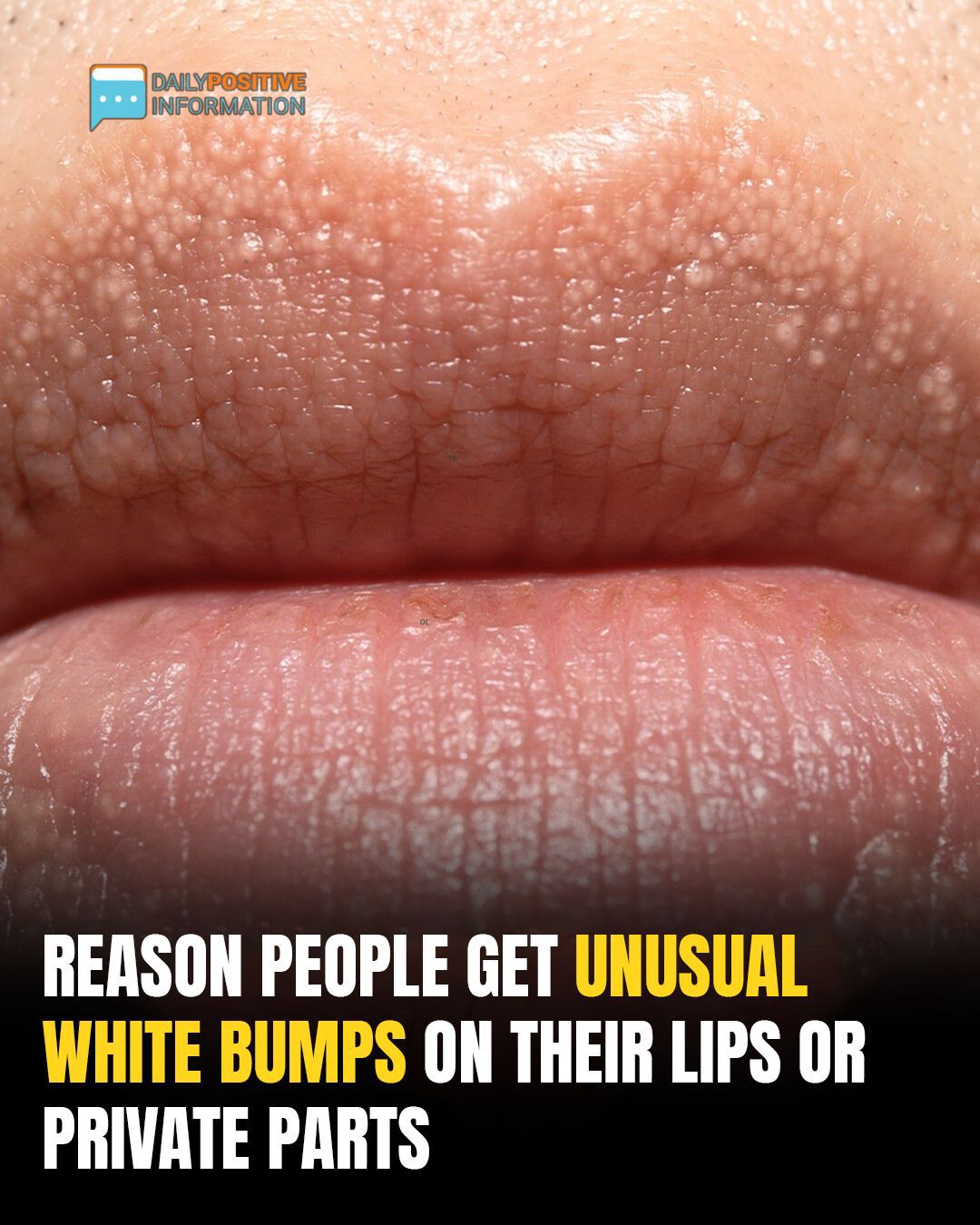 The Cause Of The Odd White Pimples On Your Your Body
