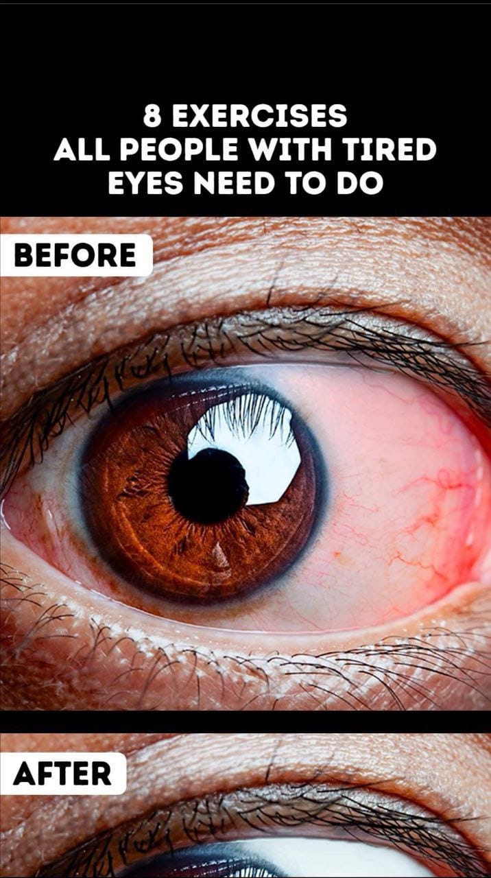 8 Eye Exercises You Can Do If Your Eyes Feel Tired