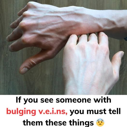 If you see someone with bulging veins, you must tell them these things