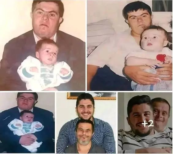 A father with Down syndrome raised his son, who is now a doctor…See more