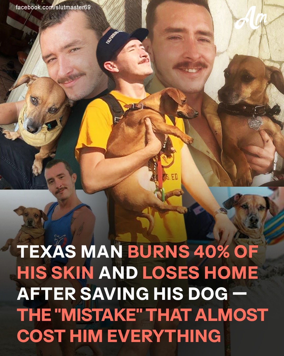 Texas Man Pleads for Donations After Losing 40% of His Skin Rescuing Dog and Home from Fire
