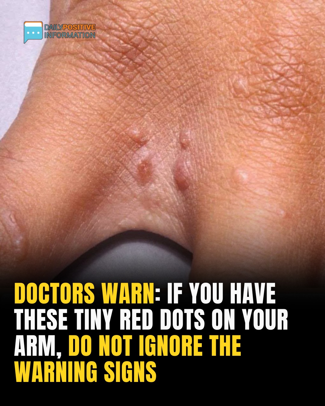 If You Have These Tiny Red Dots On Your Arm, Do Not Ignore The Warning Signs
