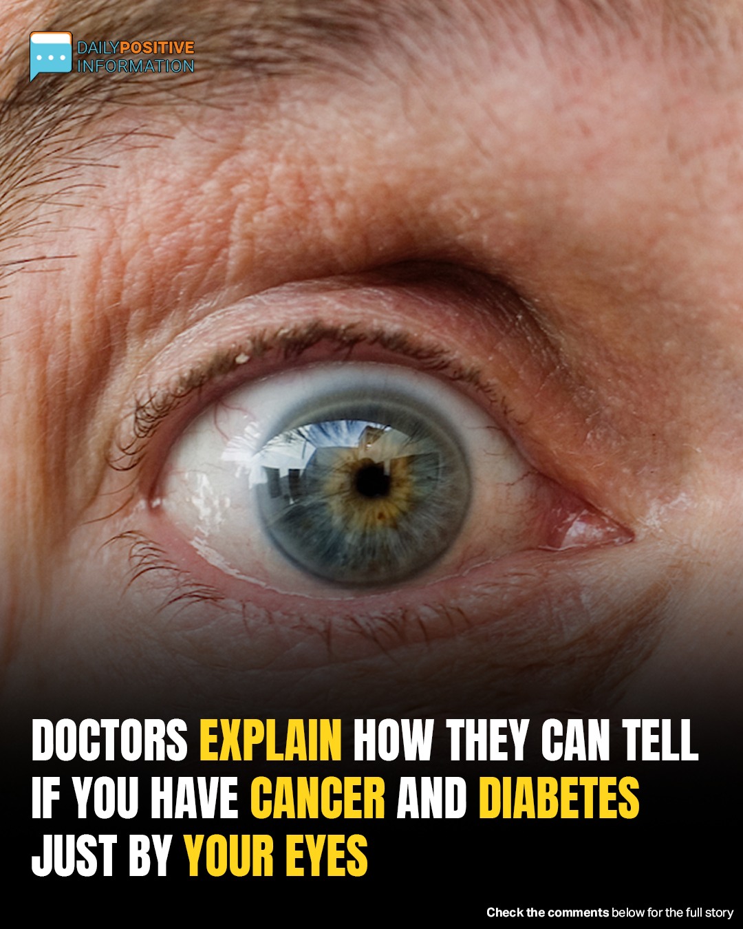 Doctors Reveal How Eye Exams Can Detect Signs Of Cancer And Diabetes