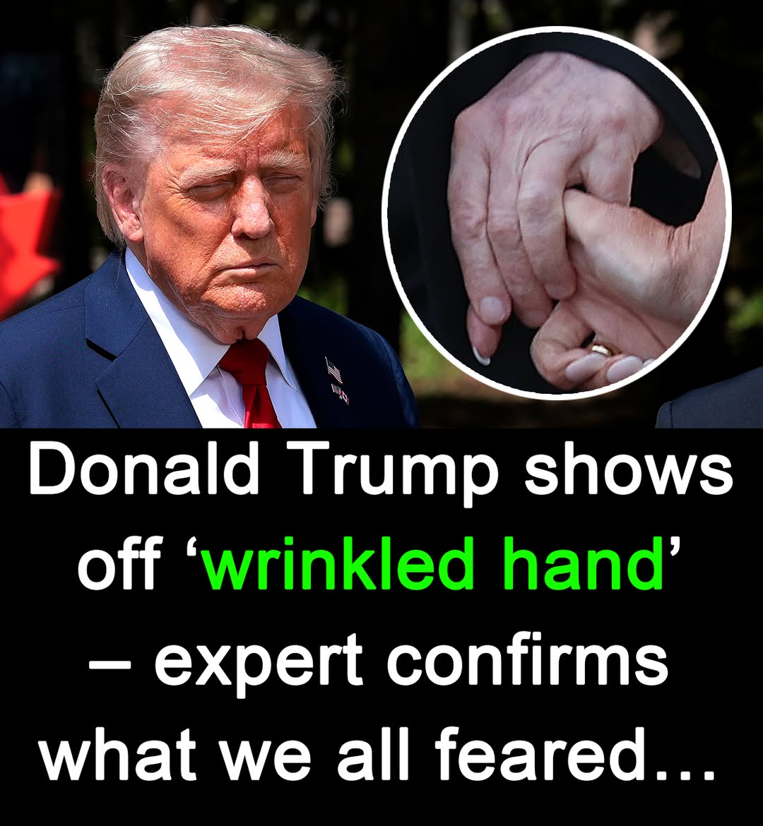 Trump shows off ‘wrinkled hands’ amid latest health fear