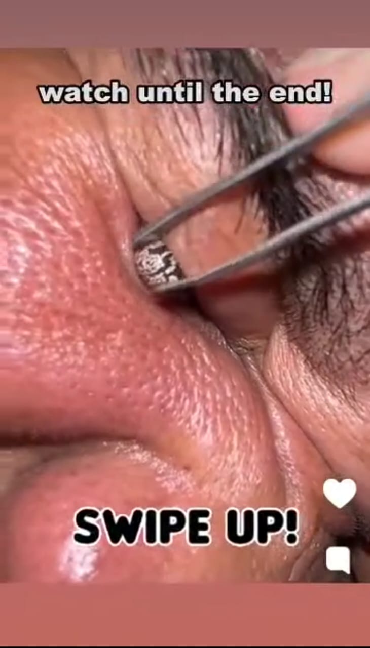 8 Eye Symptoms That Could Be a Serious Health Warning — Don’t Ignore Them