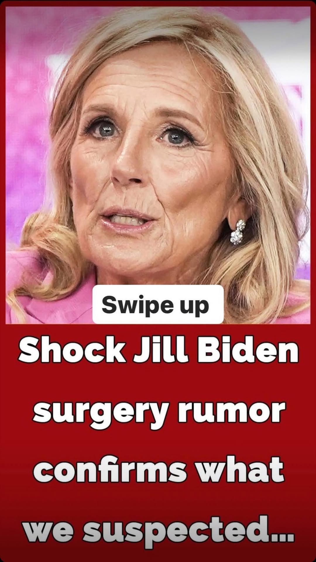 Has Jill Biden undergone plastic surgery?