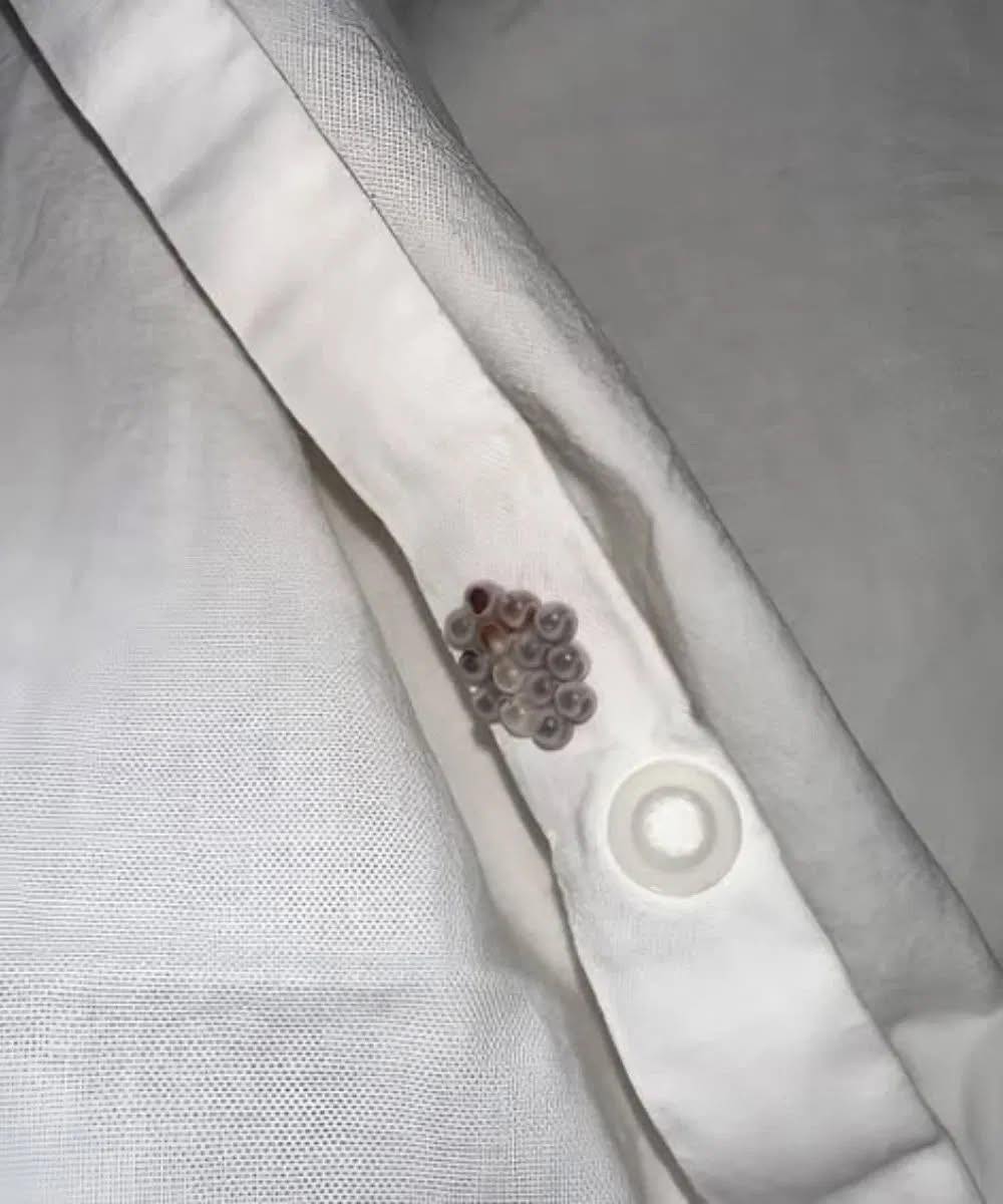 I found these tiny balls in my bed and nearly had a heart att.ack: here’s what they were