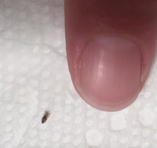 If you find this bug in your hair, you must read this