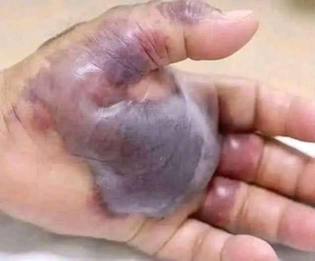 ATTENTION to these first signs of…