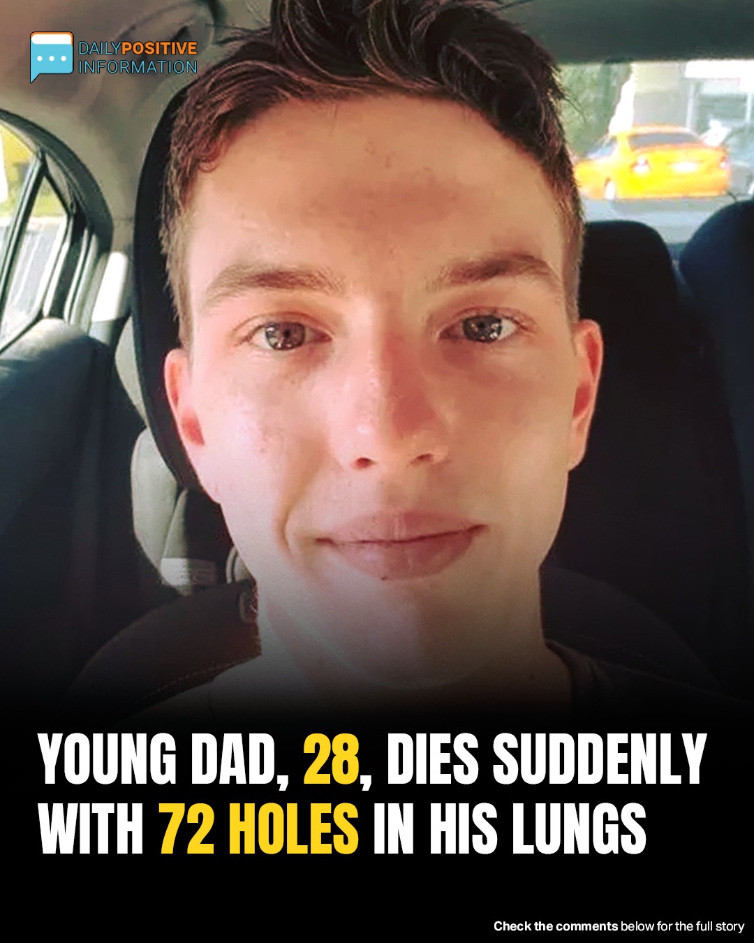 Doctors Stunned After Young Dad Dies With 72 Holes Found In His Lungs