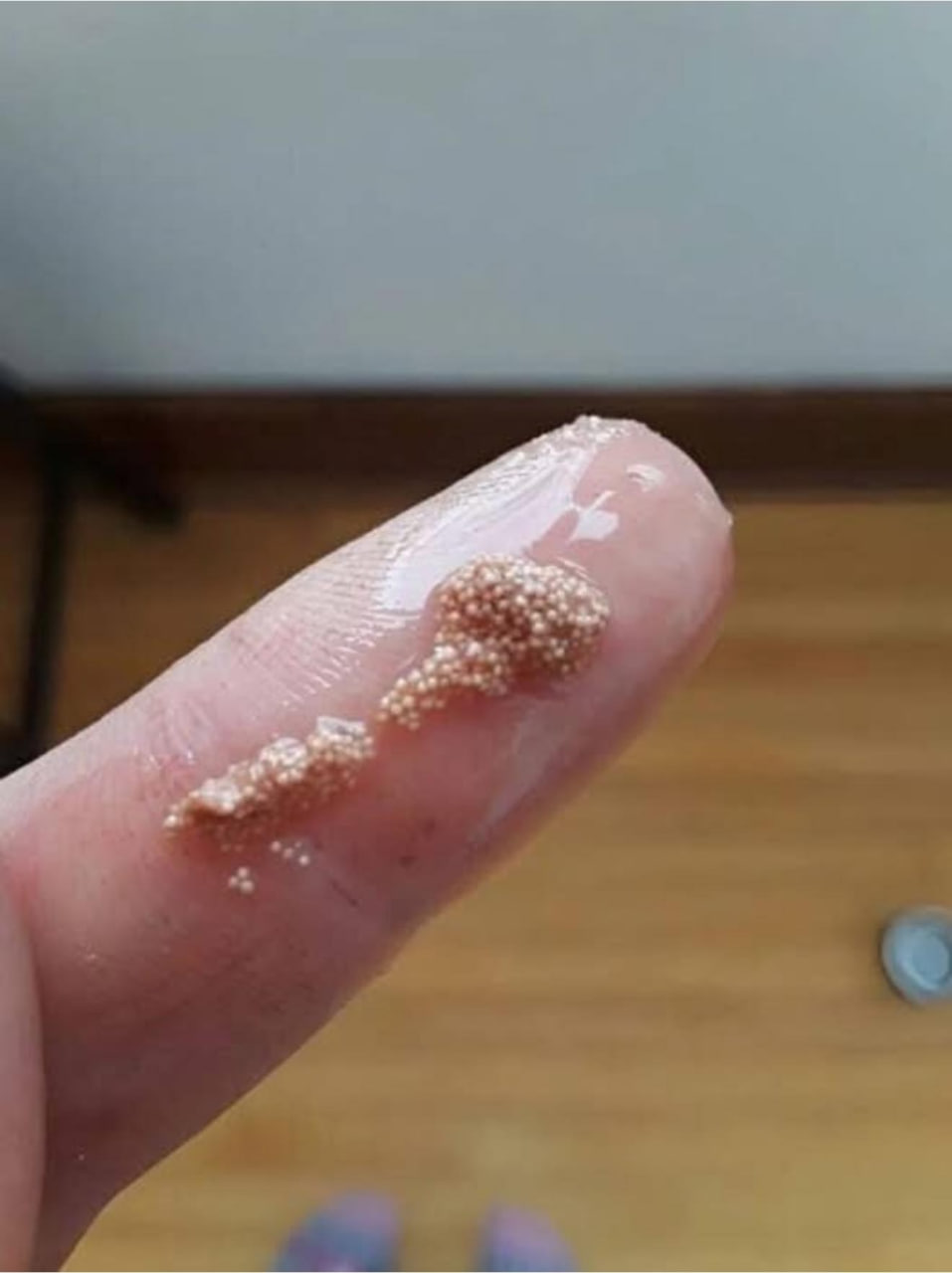 I found slimy lumps in an egg and thought they were insect eggs!