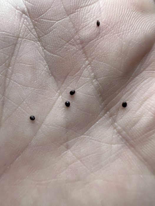 What These Mysterious Eggs in Your Yard Might Really Be