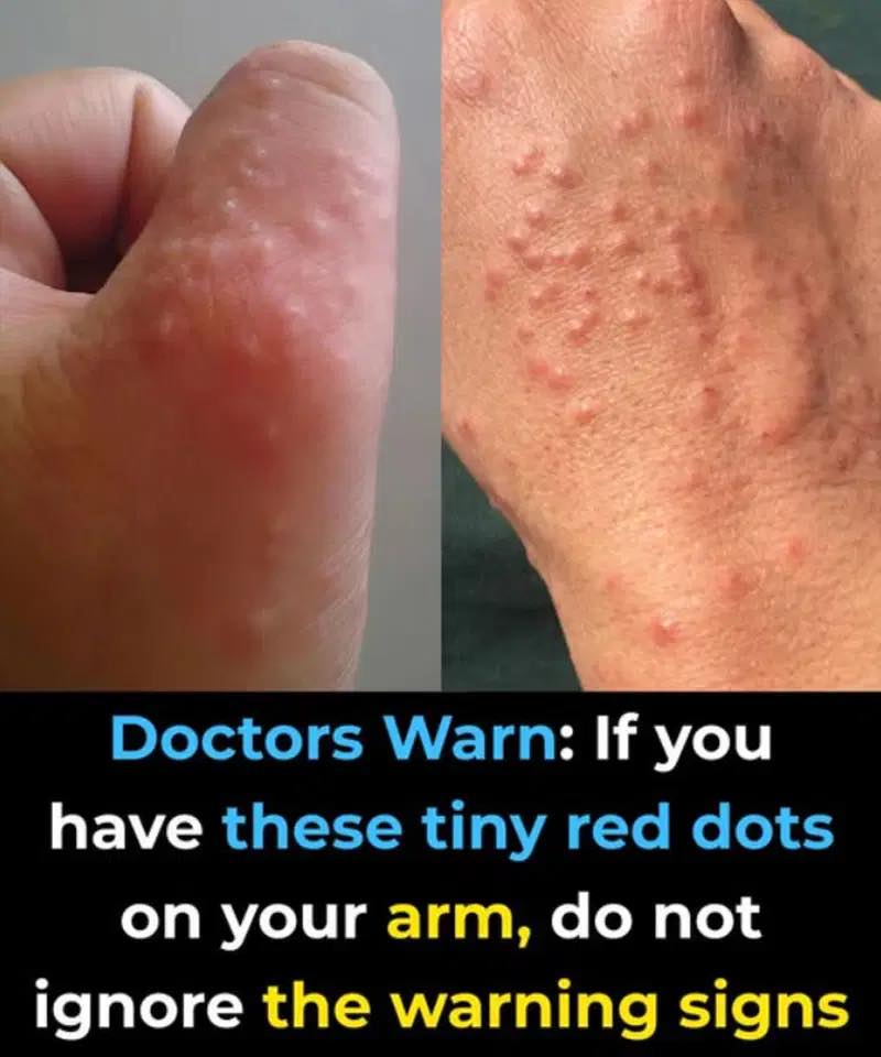 Don’t overlook these small red spots on your arm – They could be important w.arning signs