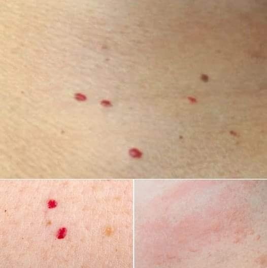 Should You Worry About Red Dots on Your Skin?