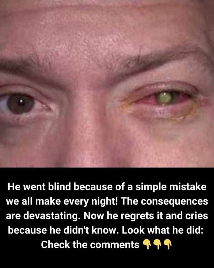 The Nightly Habit That Cost a Man His Sight: A Cautionary Tale for Contact Lens Users