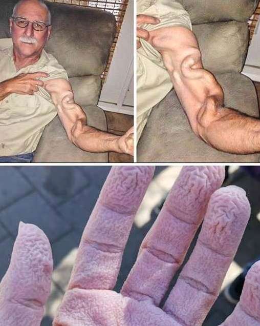 A man goes to stretch and ends up feeling a sharp pain in his arm!