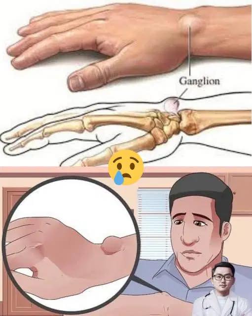 Lumps on the hands: here’s what you should know about them