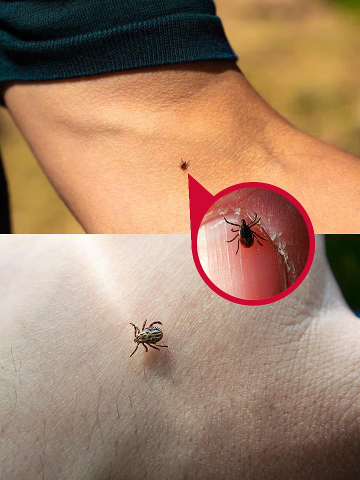 Found a tick inside? Here’s what matters most