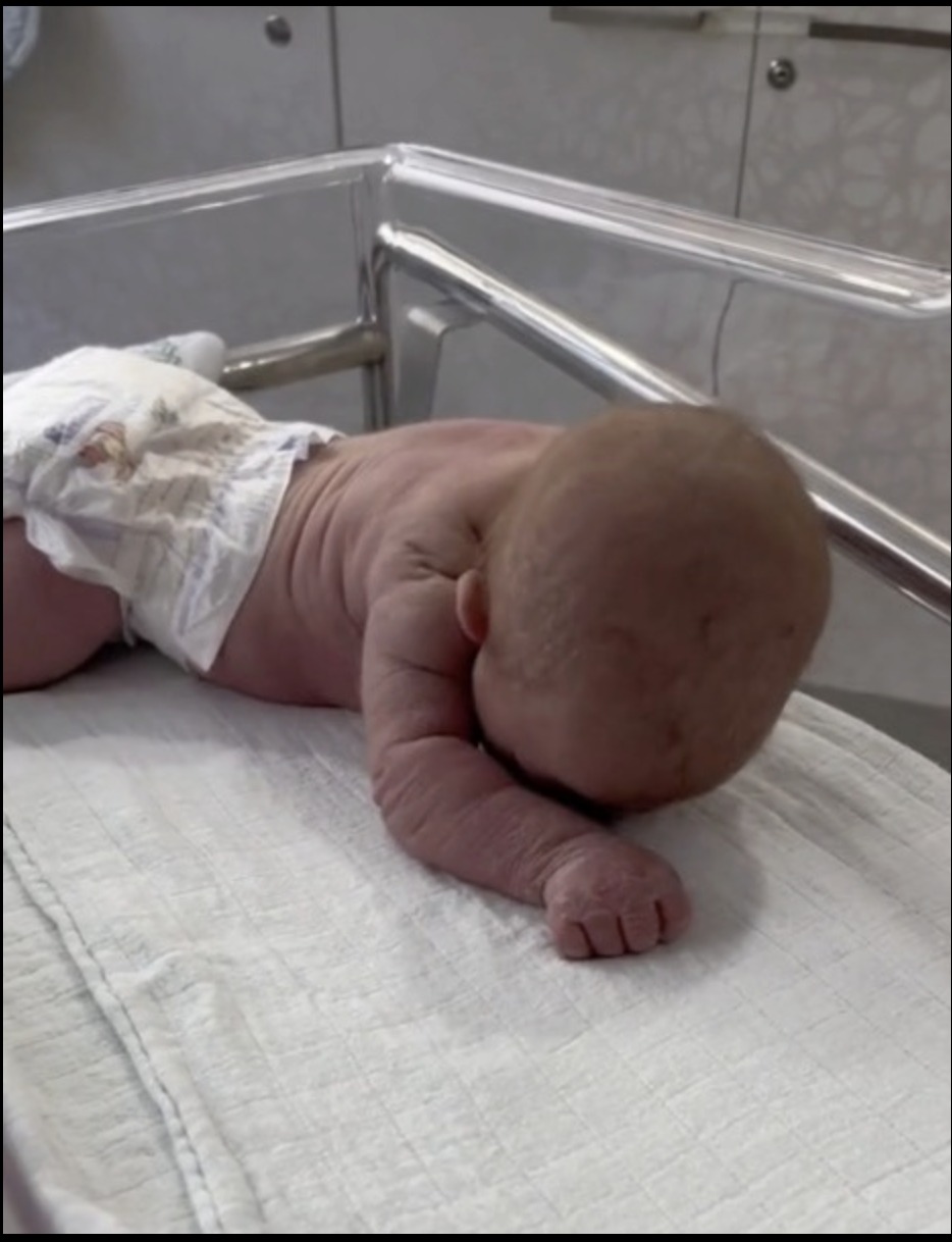 Infant crawls across hospital crib