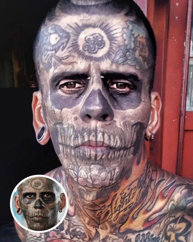 Man With 95% Of His Body Tattooed Reveals New Look After Laser Removal