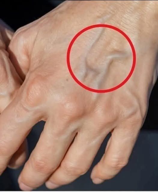 Are Blue Veins on Your Hands Normal—Or a Warning Sign of Something More Serious?