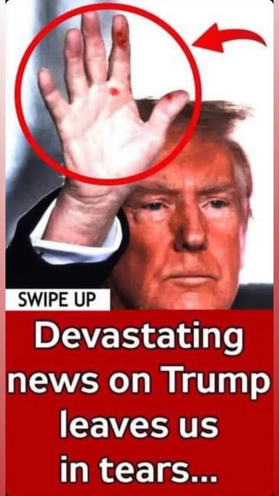 Dermatologist reveals what could be the mystery marks on Trump’s hand