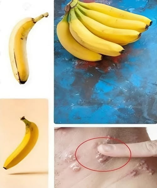 What Happens If You Eat a Banana Every Day?