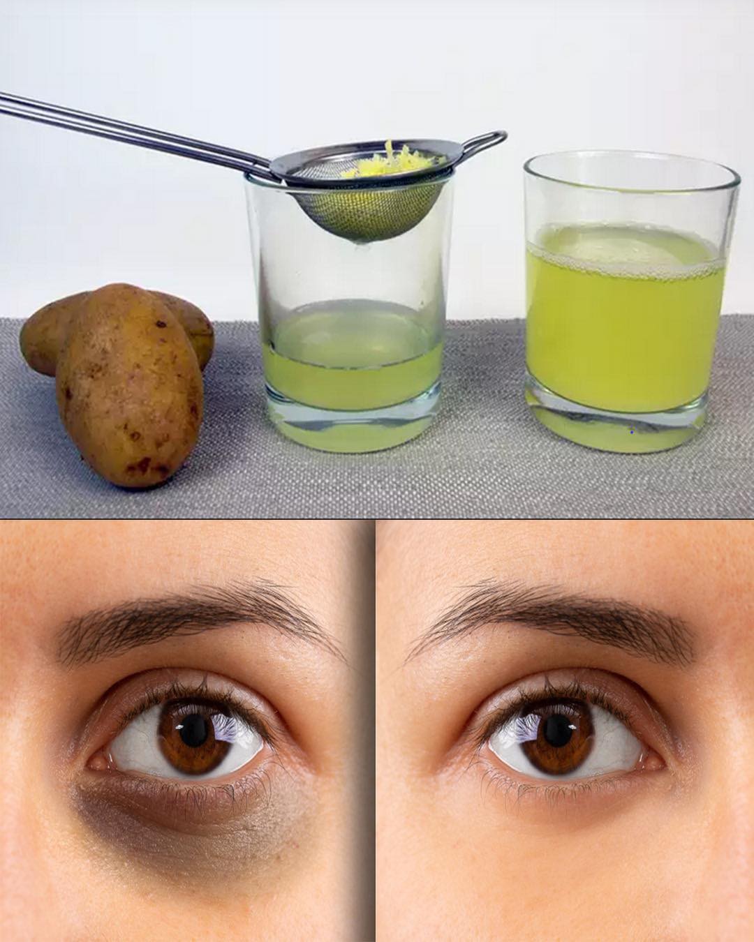 Potato Juice Power: A Natural Remedy for Dark Under-